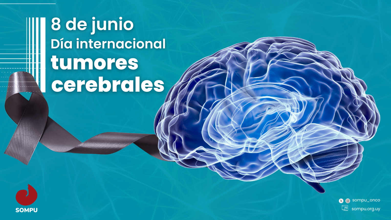 8 de junio. Día Internacional de los Tumores Cerebrales