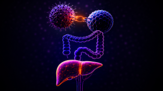 Actividad Científica: Colitis y hepatitis por inhibidores check point